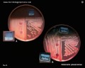 klebsiella pneumoniae biochemistry